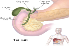 Cắt túi mật có phải lúc nào cũng cần thiết? Những điều bệnh nhân cần biết