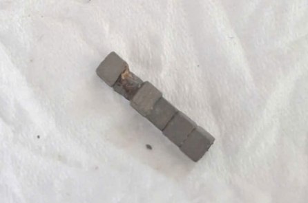 Cấp cứu bé trai nuốt 7 viên nam châm